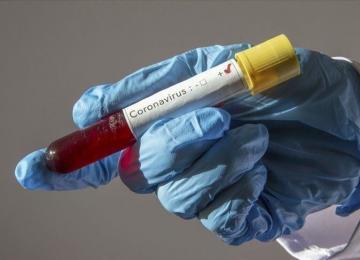 Coronavirus 
